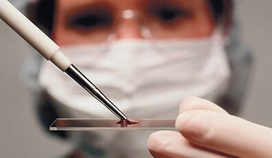 diagnosis bédana atribut sareng arthrosis