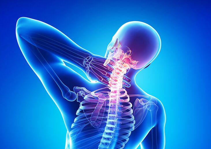 Osteochondrosis tulang tonggong mangrupikeun panyakit anu mangaruhan kartilage artikular sareng vertebrae.